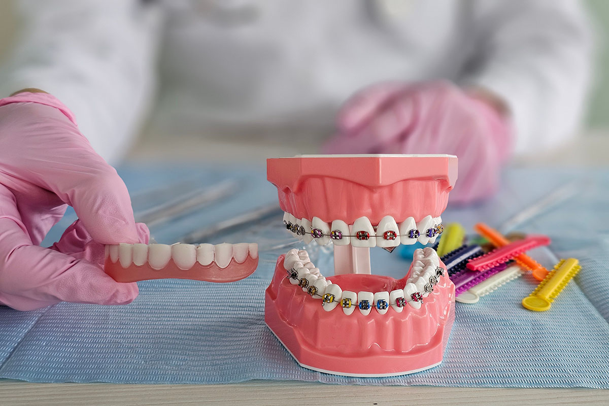 Invisalign vs. braces Invisalign and braces in Sparta
